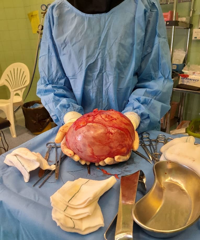 عمل جراحی اورژانسی کیست بزرگ تخمدان با موفقیت در بیمارستان امام جعفر صادق(ع) پاسارگاد انجام شد.